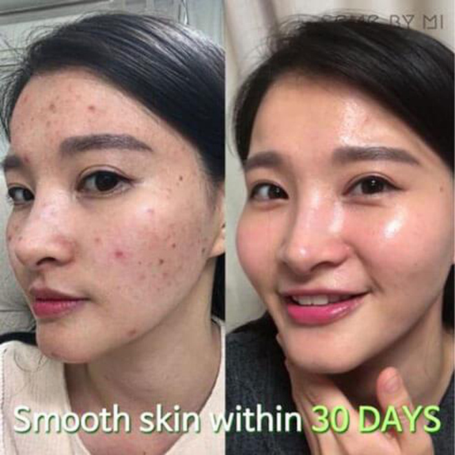 5 lọ serum Hàn giúp da căng bóng mướt mượt đón Tết sang: Nhiều loại giá mềm ai 'múc' cũng được - 8 5 lọ serum Hàn giúp da căng bóng mướt mượt đón Tết sang: Nhiều loại giá mềm ai 'múc' cũng được - 8