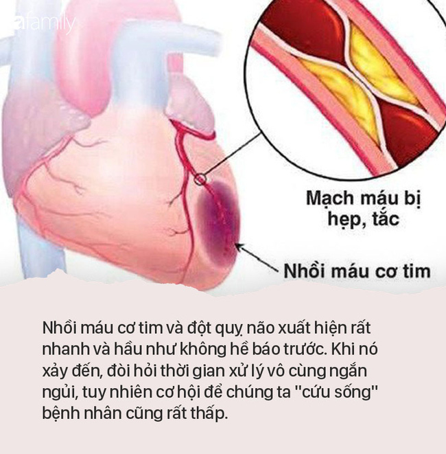Trong dịp Tết, 2 bệnh 'chết người' này gia tăng mạnh: Nghe bác sĩ BV Việt Đức chỉ cách dự phòng và phát hiện sớm - 1 Trong dịp Tết, 2 bệnh 'chết người' này gia tăng mạnh: Nghe bác sĩ BV Việt Đức chỉ cách dự phòng và phát hiện sớm - 1