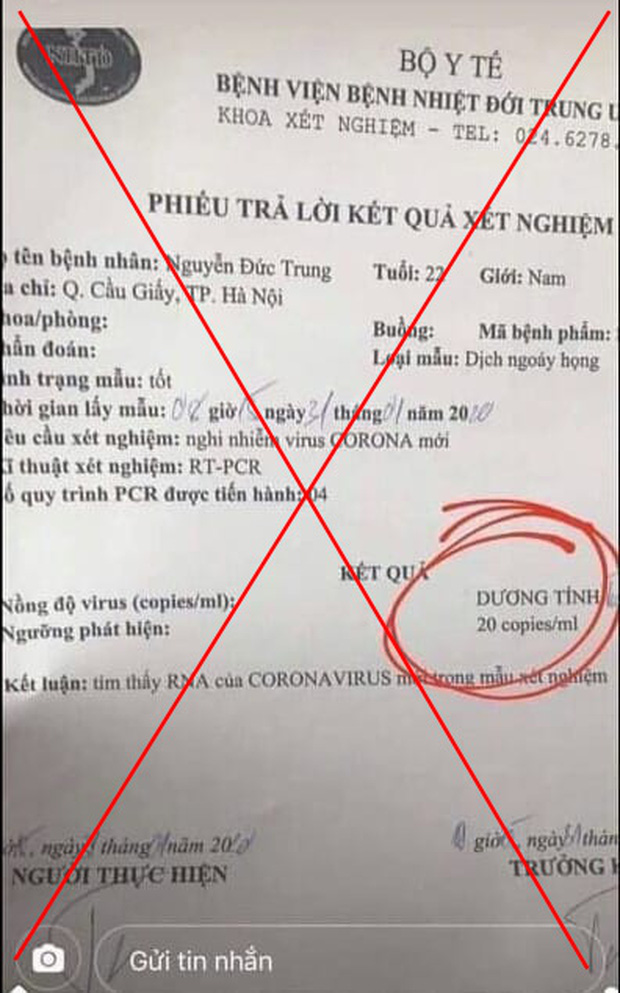 Xuất hiện kết quả xét nghiệm dương tính với nCoV giả mạo Xuất hiện kết quả xét nghiệm dương tính với nCoV giả mạo