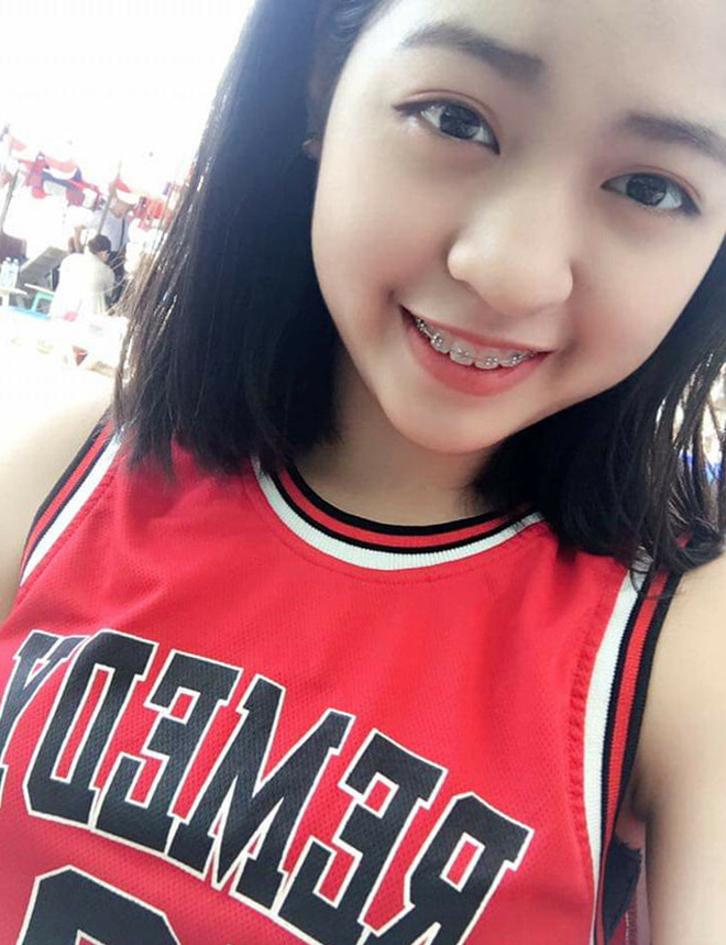 'Crush của mọi chàng trai' gây bất ngờ khi công khai ảnh quá khứ nặng 65kg, chưa niềng răng xong - 1 'Crush của mọi chàng trai' gây bất ngờ khi công khai ảnh quá khứ nặng 65kg, chưa niềng răng xong - 1