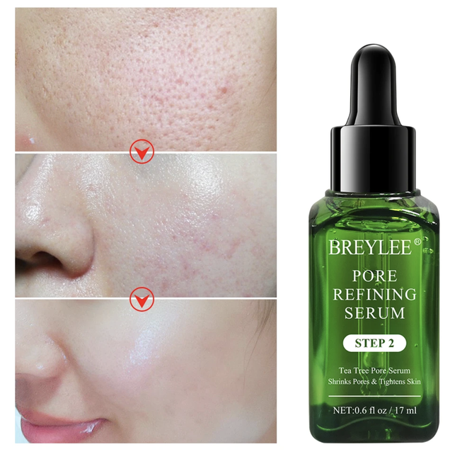 5 lọ serum cải thiện lỗ chân lông to toang hoác giá chỉ từ 280k, dùng rồi là hết nỗi sợ da xấu luôn - 2 5 lọ serum cải thiện lỗ chân lông to toang hoác giá chỉ từ 280k, dùng rồi là hết nỗi sợ da xấu luôn - 2