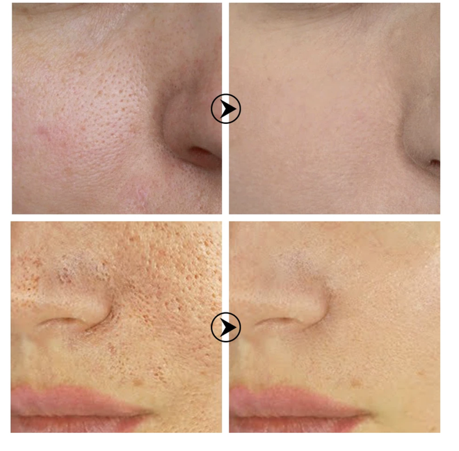 5 lọ serum cải thiện lỗ chân lông to toang hoác giá chỉ từ 280k, dùng rồi là hết nỗi sợ da xấu luôn - 3 5 lọ serum cải thiện lỗ chân lông to toang hoác giá chỉ từ 280k, dùng rồi là hết nỗi sợ da xấu luôn - 3