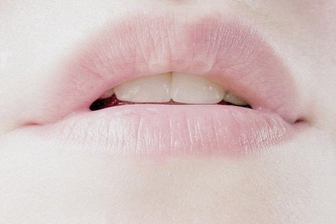 Nếu cơ thể có 4 dấu hiệu nhỏ này trên môi, mặt, tay, chân thì bạn cần kiểm tra sức khỏe ngay - 1 Nếu cơ thể có 4 dấu hiệu nhỏ này trên môi, mặt, tay, chân thì bạn cần kiểm tra sức khỏe ngay - 1
