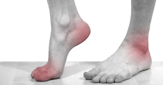 4 dấu hiệu xuất hiện ở chân cảnh báo nhiều bệnh nguy hiểm 4 dấu hiệu xuất hiện ở chân cảnh báo nhiều bệnh nguy hiểm