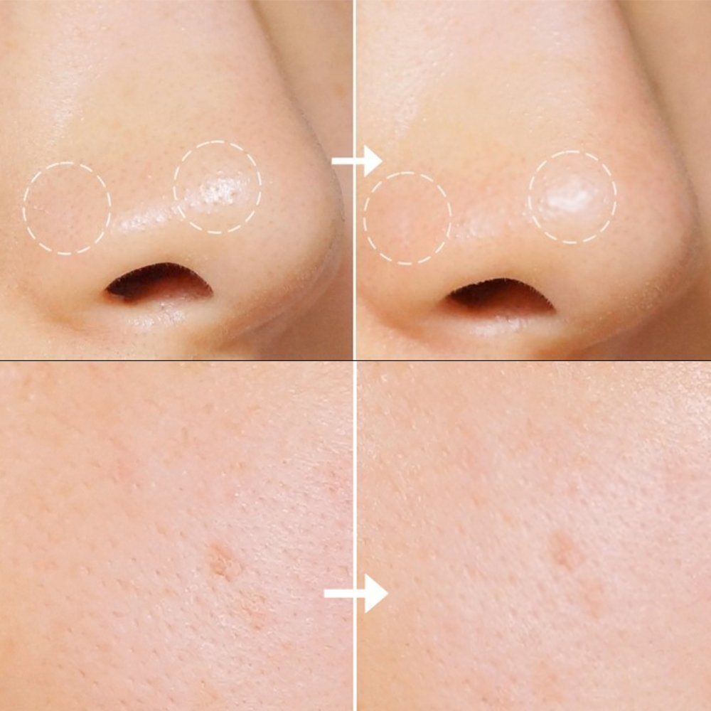 5 món skincare chân ái của các quý cô Hàn Quốc giúp lỗ chân lông từ to hóa nhỏ, làn da như trẻ ra vài tuổi - 6 5 món skincare chân ái của các quý cô Hàn Quốc giúp lỗ chân lông từ to hóa nhỏ, làn da như trẻ ra vài tuổi - 6