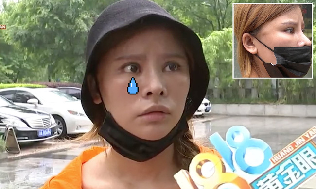 Bỏ 65 triệu làm thẩm mỹ, chị gái ức phát khóc vì nhận về khuôn mặt cau có khó chịu 24/7 Bỏ 65 triệu làm thẩm mỹ, chị gái ức phát khóc vì nhận về khuôn mặt cau có khó chịu 24/7