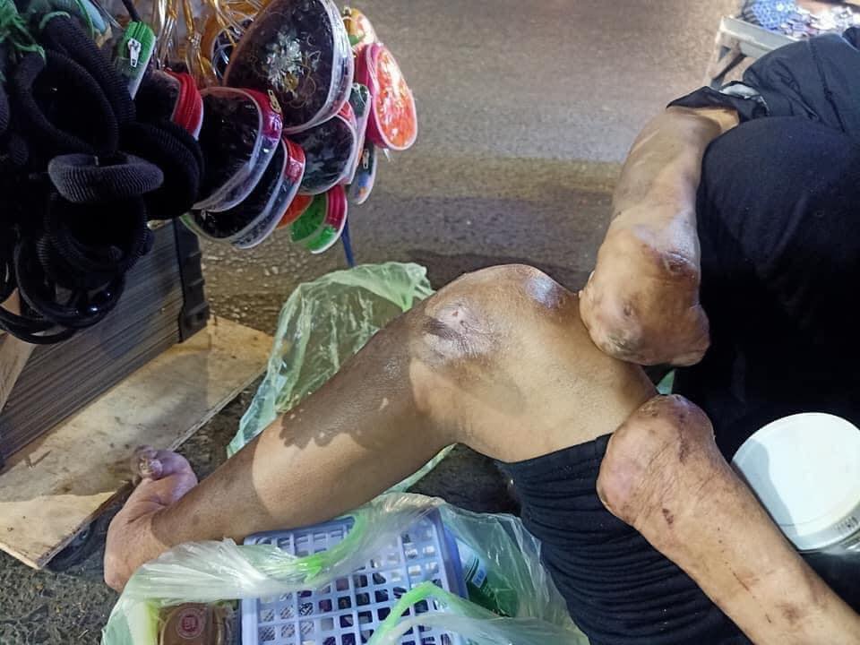 Hình ảnh bé gái xinh như thiên thần cùng người bà tật nguyền vất vả mưu sinh trong đêm Đà Lạt khiến nhiều người xúc động - 2 Hình ảnh bé gái xinh như thiên thần cùng người bà tật nguyền vất vả mưu sinh trong đêm Đà Lạt khiến nhiều người xúc động - 2