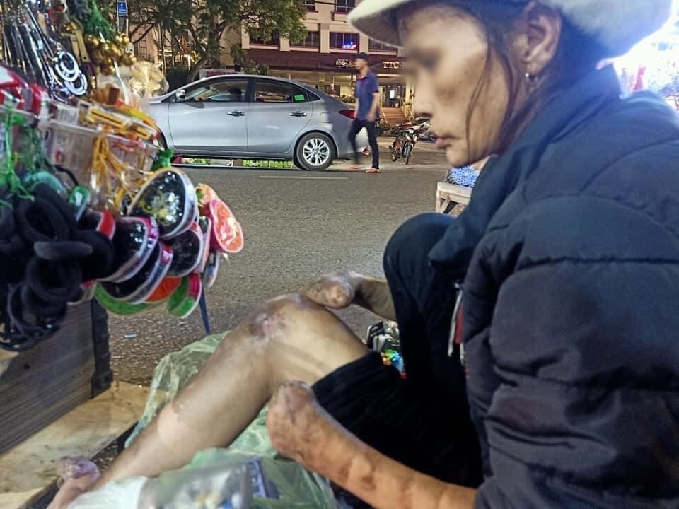 Hình ảnh bé gái xinh như thiên thần cùng người bà tật nguyền vất vả mưu sinh trong đêm Đà Lạt khiến nhiều người xúc động - 1 Hình ảnh bé gái xinh như thiên thần cùng người bà tật nguyền vất vả mưu sinh trong đêm Đà Lạt khiến nhiều người xúc động - 1