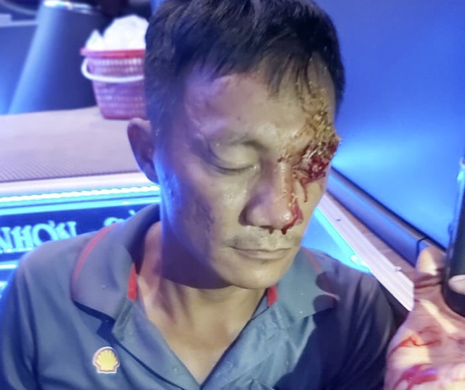 Truy tìm đối tượng bắn trọng thương phụ xe khách Truy tìm đối tượng bắn trọng thương phụ xe khách