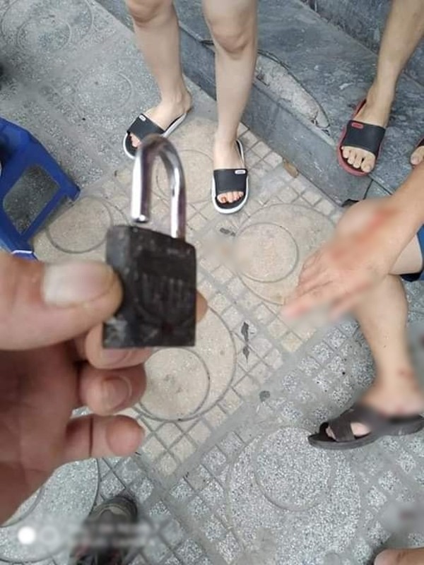 Kinh hãi những 'vật thể lạ' rơi xuống đầu cư dân các khu chung cư: Ý thức cất đi đâu vậy những người hàng xóm? - 4 Kinh hãi những 'vật thể lạ' rơi xuống đầu cư dân các khu chung cư: Ý thức cất đi đâu vậy những người hàng xóm? - 4