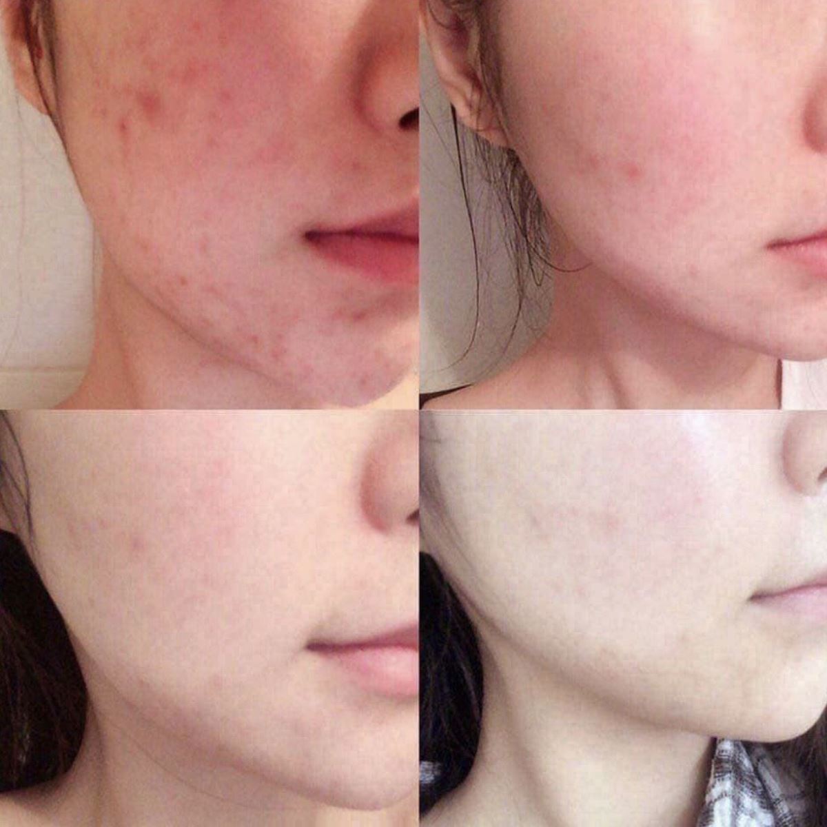 Lỗ chân lông to ngoác hay mụn đầu đen khó trị đều bị 'thu phục' nhờ 4 dòng mask đất sét chuyên dụng cho mùa Hè - 2 Lỗ chân lông to ngoác hay mụn đầu đen khó trị đều bị 'thu phục' nhờ 4 dòng mask đất sét chuyên dụng cho mùa Hè - 2