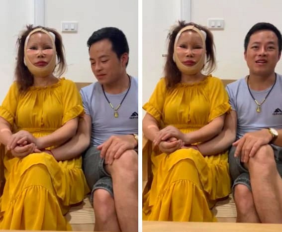Diện mạo mới của cô dâu 62 tuổi ở Cao Bằng sau 3 ngày khiến dân mạng khiếp vía vì hậu phẫu căng da mặt Diện mạo mới của cô dâu 62 tuổi ở Cao Bằng sau 3 ngày khiến dân mạng khiếp vía vì hậu phẫu căng da mặt