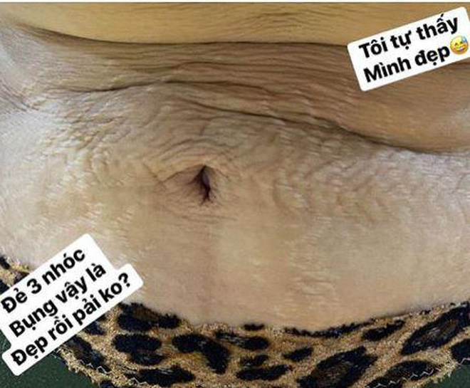 'Bà mẹ 3 con' Hải Băng gây choáng với màn lột xác ngoạn mục từ bụng rạn nhăn nheo đến vòng eo siêu nuột không tì vết 'Bà mẹ 3 con' Hải Băng gây choáng với màn lột xác ngoạn mục từ bụng rạn nhăn nheo đến vòng eo siêu nuột không tì vết