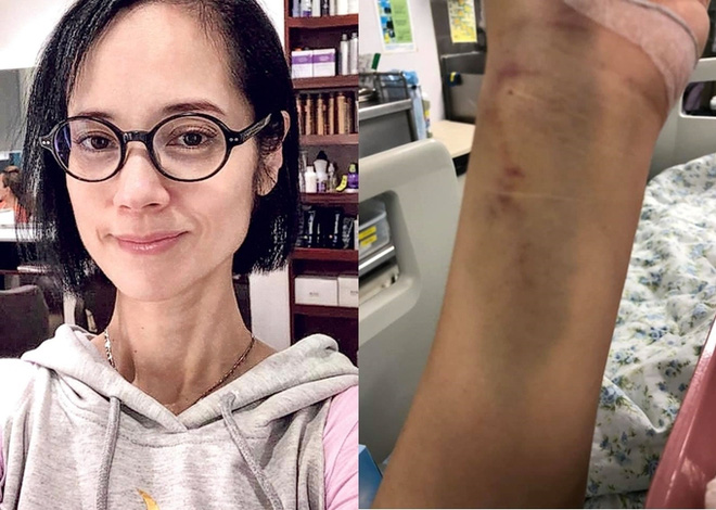 'Nữ hoàng phim nóng Hong Kong': Sự nghiệp, sức khỏe lao dốc sau khi đại gia đỡ đầu qua đời - 9 'Nữ hoàng phim nóng Hong Kong': Sự nghiệp, sức khỏe lao dốc sau khi đại gia đỡ đầu qua đời - 9