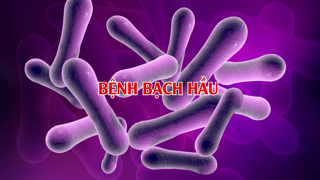Bệnh bạch hầu 'tái xuất' nguy hiểm: Bác sĩ lưu ý những điều quan trọng - 1 Bệnh bạch hầu 'tái xuất' nguy hiểm: Bác sĩ lưu ý những điều quan trọng - 1