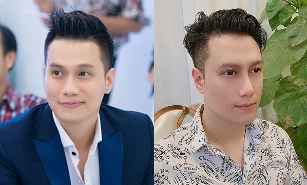 Việt Anh gây thất vọng với ngoại hình hậu thẩm mỹ, vợ cũ bất ngờ phát biểu: 'Rời vòng tay em là thế đó' - 6 Việt Anh gây thất vọng với ngoại hình hậu thẩm mỹ, vợ cũ bất ngờ phát biểu: 'Rời vòng tay em là thế đó' - 6