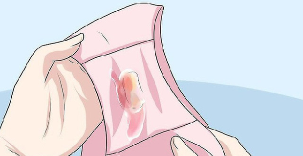 4 'chất tiết' xuất hiện trên đồ lót ngầm nhắc nhở vùng kín của con gái đang gặp vấn đề 4 'chất tiết' xuất hiện trên đồ lót ngầm nhắc nhở vùng kín của con gái đang gặp vấn đề