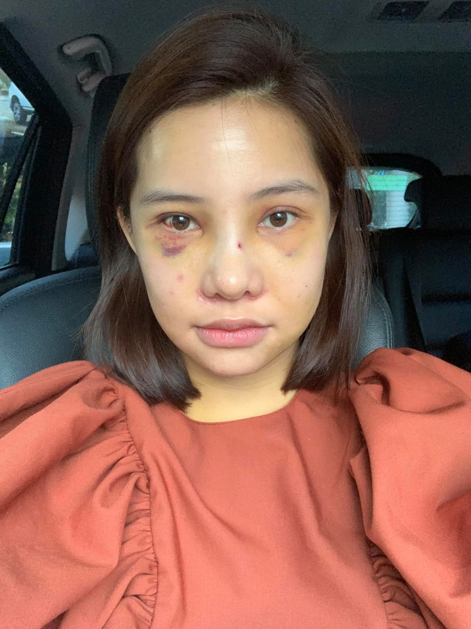 Loạt scandal mang tên Lưu Đê Ly: Khổ sở vì nghi án "giật chồng", nóng nhất vụ ẩu đả với antifan và bị Hồng Quế dằn mặt - 6 Loạt scandal mang tên Lưu Đê Ly: Khổ sở vì nghi án "giật chồng", nóng nhất vụ ẩu đả với antifan và bị Hồng Quế dằn mặt - 6