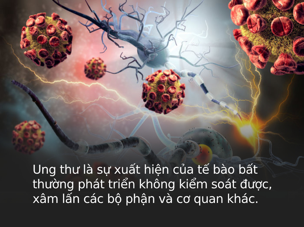 Loại ung thư mà 'người giàu' và 'người nghèo' dễ mắc nhất là gì? Câu trả lời sẽ khiến bạn phải thay đổi thói quen sống gấp Loại ung thư mà 'người giàu' và 'người nghèo' dễ mắc nhất là gì? Câu trả lời sẽ khiến bạn phải thay đổi thói quen sống gấp