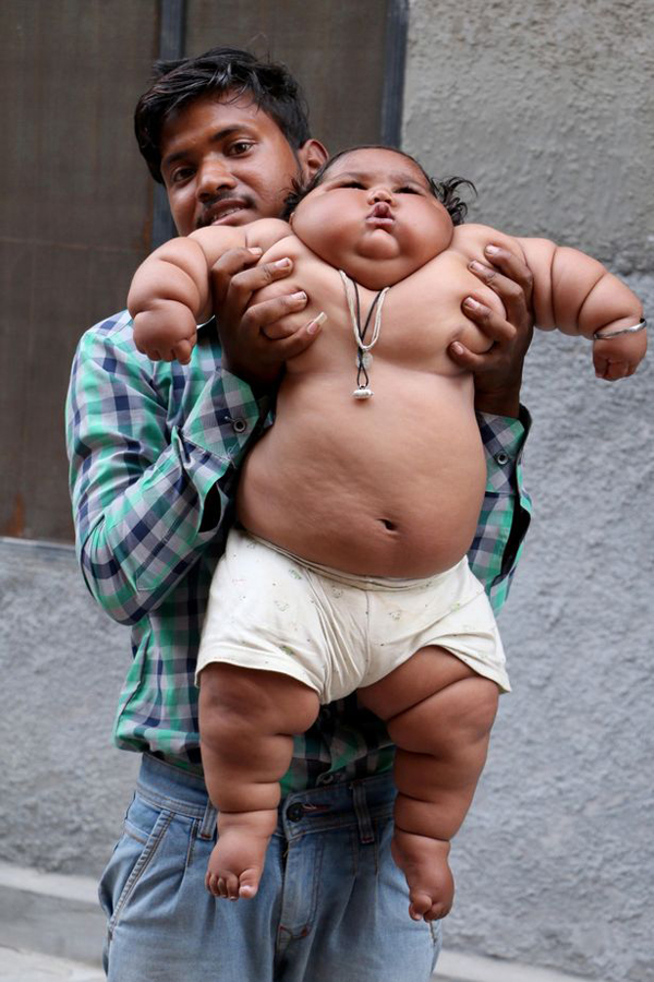 Bé gái ú na ú nần đột nhiên nổi tiếng vì 8 tháng tuổi đã nặng 17kg, sau 2 năm giờ ra sao? - 3 Bé gái ú na ú nần đột nhiên nổi tiếng vì 8 tháng tuổi đã nặng 17kg, sau 2 năm giờ ra sao? - 3