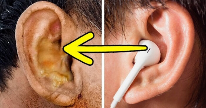 Hiểm họa khôn lường từ việc dùng chung tai nghe Hiểm họa khôn lường từ việc dùng chung tai nghe