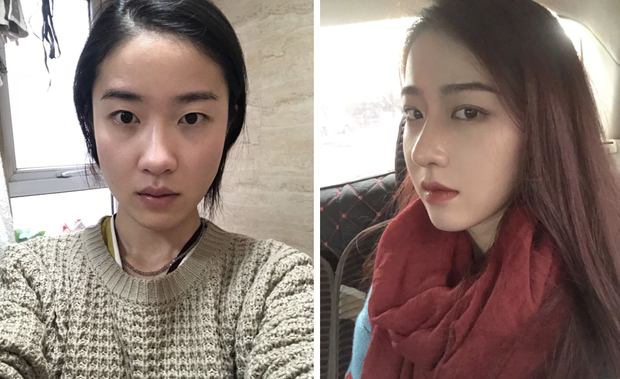 Chùm ảnh: Những cô gái hoá thành hot girl nhờ 'dao kéo' đúng chỗ - 2 Chùm ảnh: Những cô gái hoá thành hot girl nhờ 'dao kéo' đúng chỗ - 2