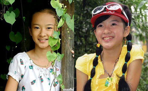 6 sao Việt khổ sở vì 'dao kéo' biến dạng: Angela Phương Trinh lệch hẳn 1 bên mũi, Hồ Quỳnh Hương - Phi Thanh Vân gây choáng - 5 6 sao Việt khổ sở vì 'dao kéo' biến dạng: Angela Phương Trinh lệch hẳn 1 bên mũi, Hồ Quỳnh Hương - Phi Thanh Vân gây choáng - 5