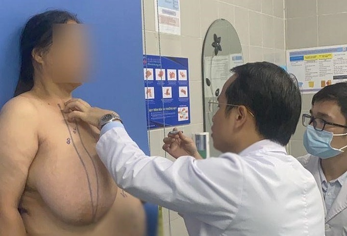 Người phụ nữ 28 năm chịu đựng bộ ngực khổng lồ Người phụ nữ 28 năm chịu đựng bộ ngực khổng lồ