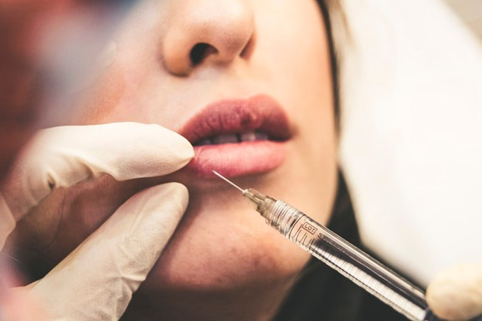 Liệt nửa mặt sau tiêm filler xóa nếp nhăn - 1 Liệt nửa mặt sau tiêm filler xóa nếp nhăn - 1