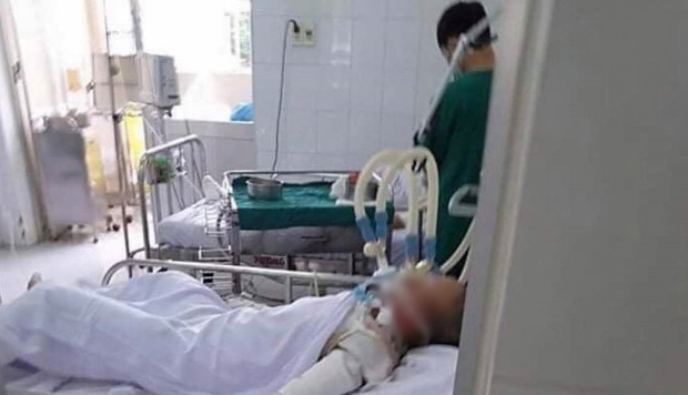 Vụ thiếu nữ 15 tuổi bị đổ xăng đốt chết: Bắt gã bạn trai máu lạnh - 1 Vụ thiếu nữ 15 tuổi bị đổ xăng đốt chết: Bắt gã bạn trai máu lạnh - 1