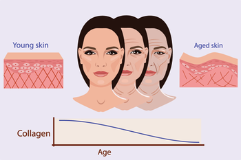 Tại sao nếp nhăn lại xuất hiện khi ta già đi? Tại sao nếp nhăn lại xuất hiện khi ta già đi?