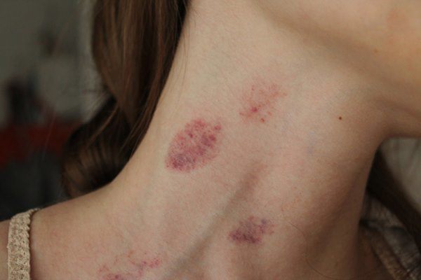 Khi 'quan hệ' có 1 bộ phận là 'vùng cấm hôn', thích đến mấy vợ chồng cũng đừng chạm vào - 1 Khi 'quan hệ' có 1 bộ phận là 'vùng cấm hôn', thích đến mấy vợ chồng cũng đừng chạm vào - 1