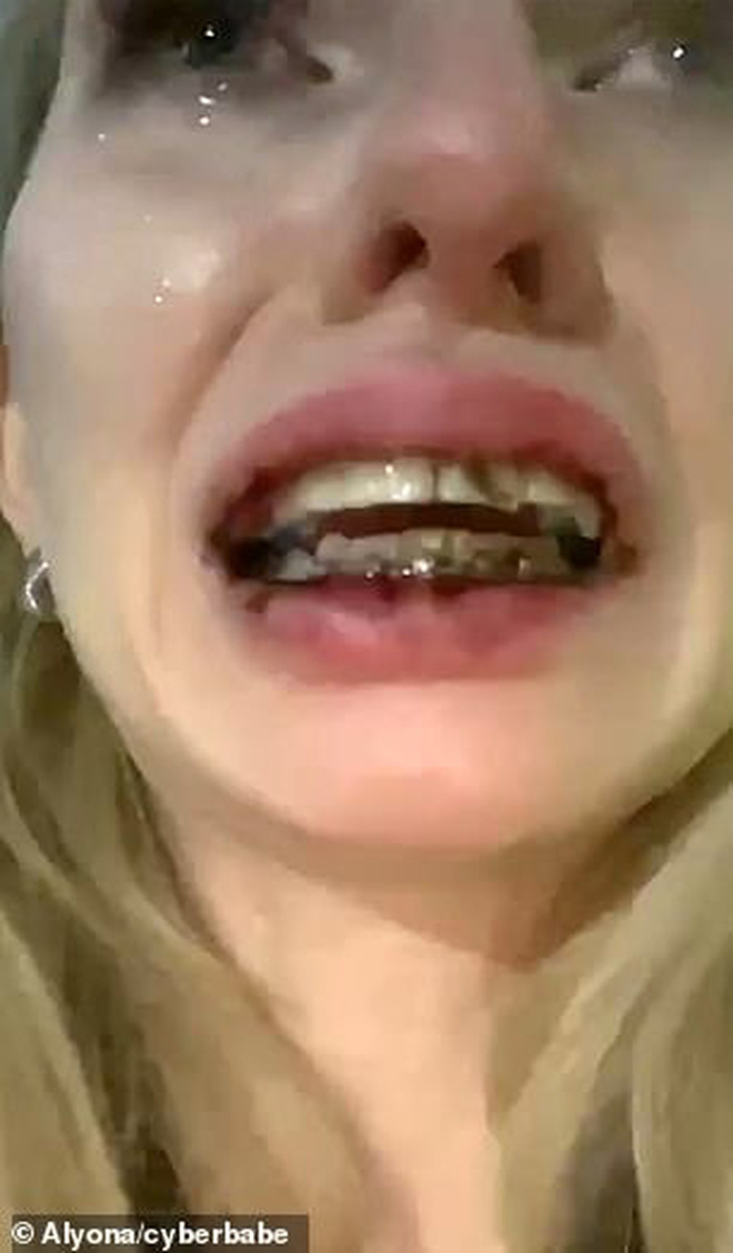 Mẫu nữ bị đánh đập dã man đến gãy cả niềng răng khi đang livestream trên kênh YouTube có gần 700 nghìn subscriber - 3 Mẫu nữ bị đánh đập dã man đến gãy cả niềng răng khi đang livestream trên kênh YouTube có gần 700 nghìn subscriber - 3