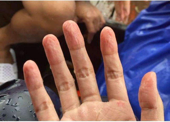 Thủy Tiên xuất hiện tươi cười tại nhà riêng sau chuyến cứu trợ miền Trung nhưng nhìn đôi chân mà ai cũng xót - 1 Thủy Tiên xuất hiện tươi cười tại nhà riêng sau chuyến cứu trợ miền Trung nhưng nhìn đôi chân mà ai cũng xót - 1