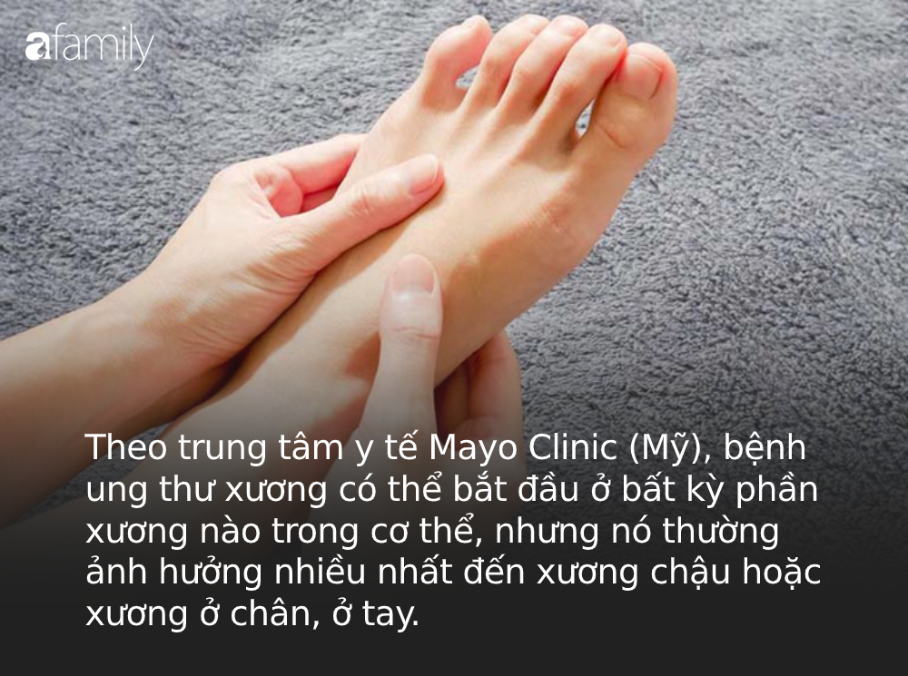 Bỗng dưng thấy bàn chân thay đổi theo 3 cách này, coi chừng bệnh ung thư đang phát triển trong cơ thể, cần lập tức đi khám - 3 Bỗng dưng thấy bàn chân thay đổi theo 3 cách này, coi chừng bệnh ung thư đang phát triển trong cơ thể, cần lập tức đi khám - 3