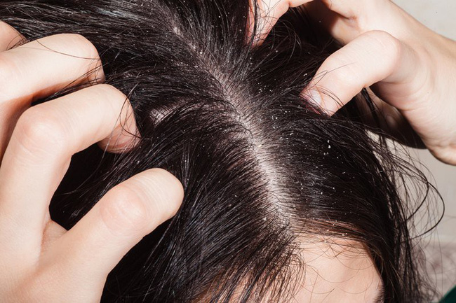 Chủ Salon tóc người Hàn chỉ ra sai lầm tai hại khi gội đầu: Hội con gái Hàn không bao giờ mắc phải vì hại tóc cực kỳ - 3 Chủ Salon tóc người Hàn chỉ ra sai lầm tai hại khi gội đầu: Hội con gái Hàn không bao giờ mắc phải vì hại tóc cực kỳ - 3