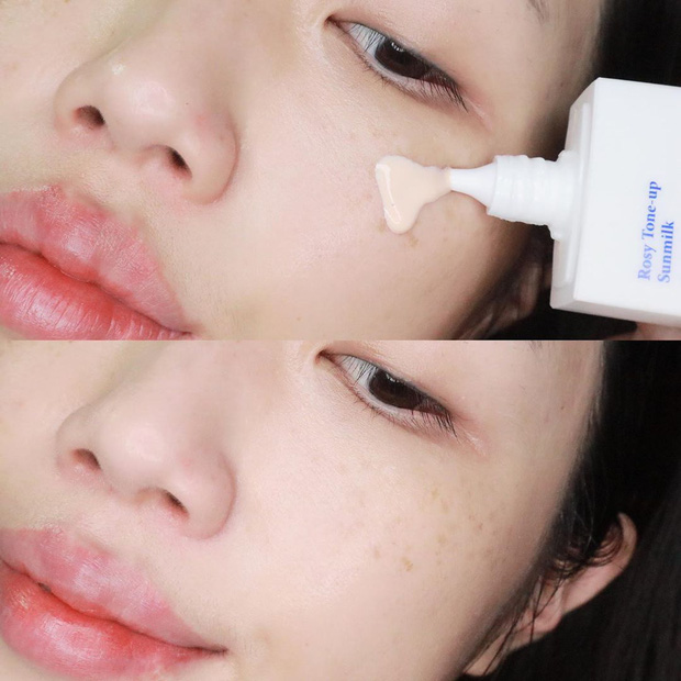 Biết 6 chiêu nặn mụn đúng cách, da sẽ nhanh lành, vết thâm cũng không có cửa xuất hiện - 2 Biết 6 chiêu nặn mụn đúng cách, da sẽ nhanh lành, vết thâm cũng không có cửa xuất hiện - 2