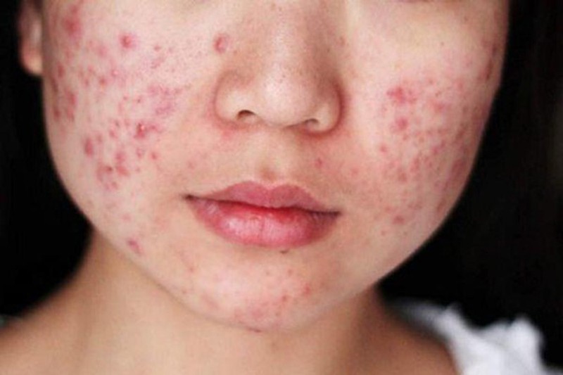 Người phụ nữ dễ mắc bệnh phụ khoa, tử cung 'yếu' thường sẽ có 3 đặc điểm ở miệng - 3 Người phụ nữ dễ mắc bệnh phụ khoa, tử cung 'yếu' thường sẽ có 3 đặc điểm ở miệng - 3