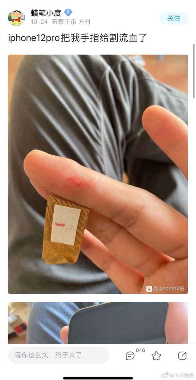 Người dùng phàn nàn iPhone 12 gây sưng tay Người dùng phàn nàn iPhone 12 gây sưng tay