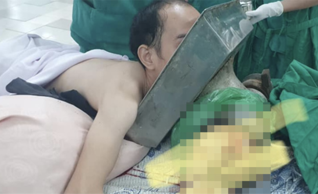Tai nạn kinh hoàng: Chàng trai 27 tuổi bị máy xay thịt cuốn cả cánh tay đến sát vai, mặt bị kéo vào mâm inox, tình trạng nguy kịch Tai nạn kinh hoàng: Chàng trai 27 tuổi bị máy xay thịt cuốn cả cánh tay đến sát vai, mặt bị kéo vào mâm inox, tình trạng nguy kịch