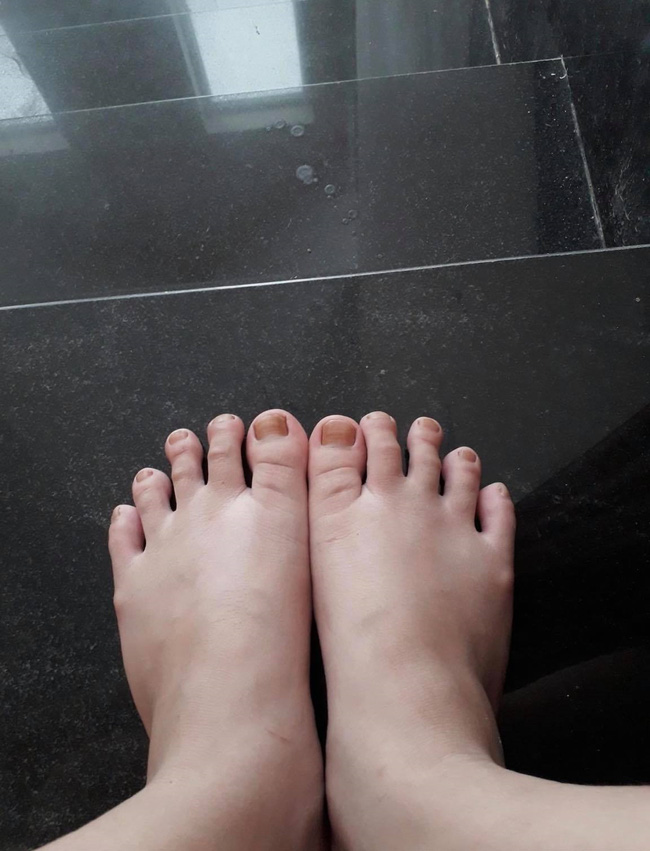 Tân Hoa hậu Đỗ Thị Hà đã tự công khai điểm 'thô kệch' trên cơ thể trước khi đăng quang Hoa hậu Việt Nam Tân Hoa hậu Đỗ Thị Hà đã tự công khai điểm 'thô kệch' trên cơ thể trước khi đăng quang Hoa hậu Việt Nam