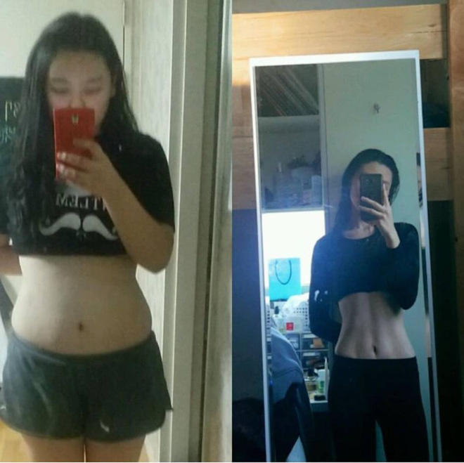 Giảm 50kg trong 2 năm nhưng lại mắc phải chứng biếng ăn, hotgirl Hàn rút ra 5 bí quyết giảm cân nhanh và lành mạnh - 1 Giảm 50kg trong 2 năm nhưng lại mắc phải chứng biếng ăn, hotgirl Hàn rút ra 5 bí quyết giảm cân nhanh và lành mạnh - 1