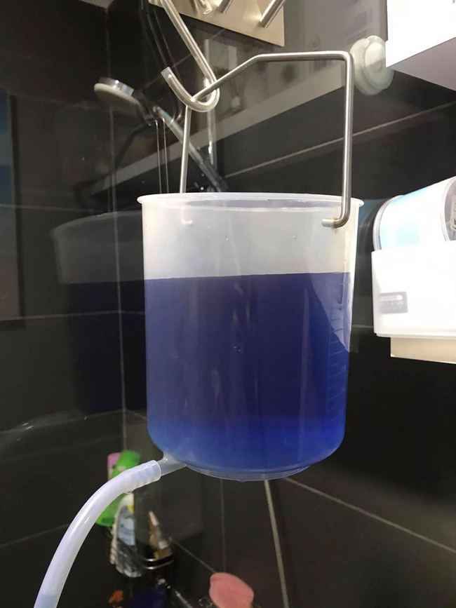 Tự ý bơm thụt cà phê để... detox cơ thể: Chuyên gia khẳng định nguy hiểm và không có bằng chứng khoa học! Tự ý bơm thụt cà phê để... detox cơ thể: Chuyên gia khẳng định nguy hiểm và không có bằng chứng khoa học!