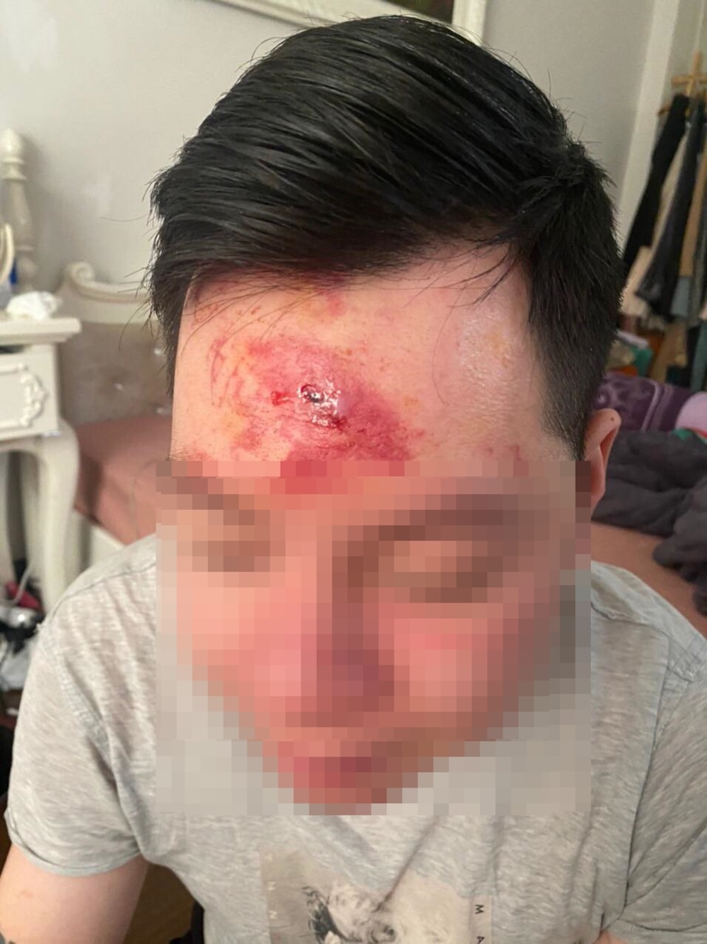 Mời rượu không uống, nhân viên quán bar xông vào đánh khách rách trán Mời rượu không uống, nhân viên quán bar xông vào đánh khách rách trán