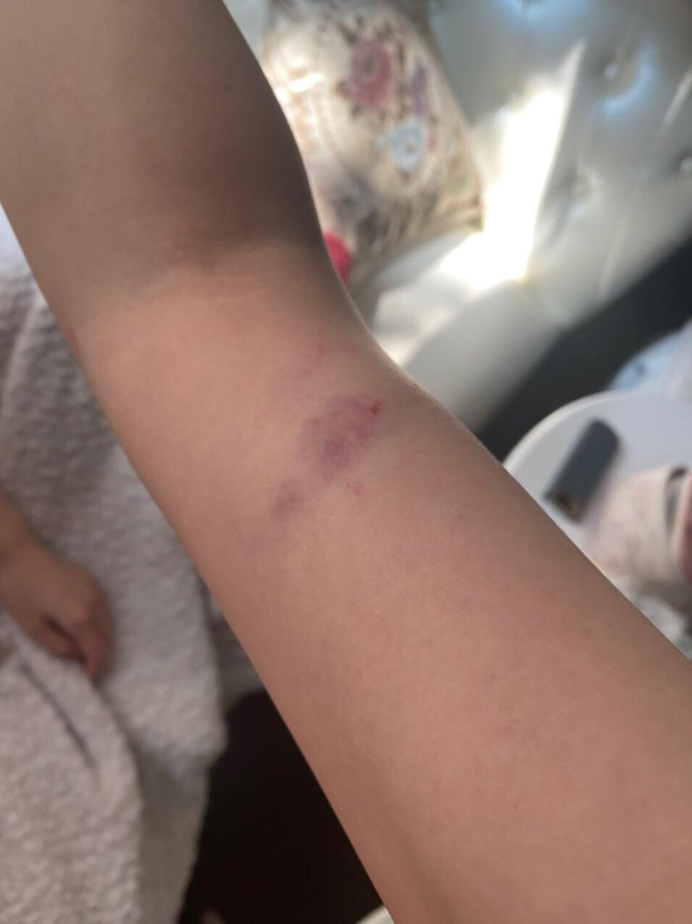 Mời rượu không uống, nhân viên quán bar xông vào đánh khách rách trán - 3 Mời rượu không uống, nhân viên quán bar xông vào đánh khách rách trán - 3