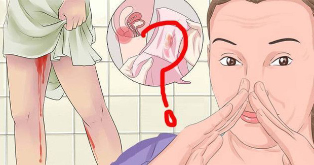 2 mùi khó chịu xuất hiện ở vùng kín có thể là dấu hiệu nhiễm HPV, làm thêm 3 việc sẽ giúp đẩy lùi tình trạng này 2 mùi khó chịu xuất hiện ở vùng kín có thể là dấu hiệu nhiễm HPV, làm thêm 3 việc sẽ giúp đẩy lùi tình trạng này