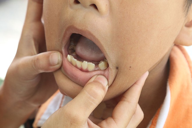 Cuộc chạy trốn của bé gái 10 tuổi và em trai ở Đồng Nai - 1 Cuộc chạy trốn của bé gái 10 tuổi và em trai ở Đồng Nai - 1