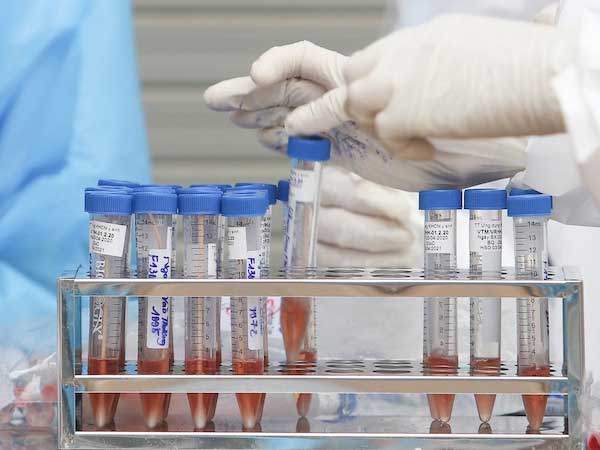Một người Hà Nội test nhanh dương tính nCoV tại Nhật Một người Hà Nội test nhanh dương tính nCoV tại Nhật