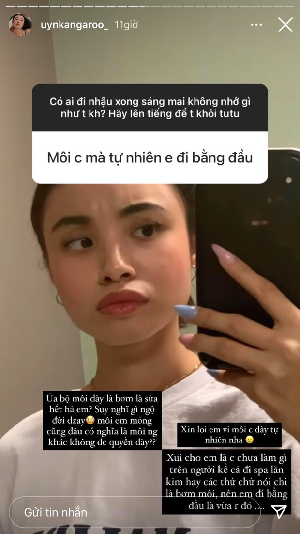 Gái xinh nổi tiếng với loạt vlog trong ô tô 'phản dame' cực gắt trước nghi vấn dao kéo: 'Môi dày là bơm hay sửa hết hả?' Gái xinh nổi tiếng với loạt vlog trong ô tô 'phản dame' cực gắt trước nghi vấn dao kéo: 'Môi dày là bơm hay sửa hết hả?'