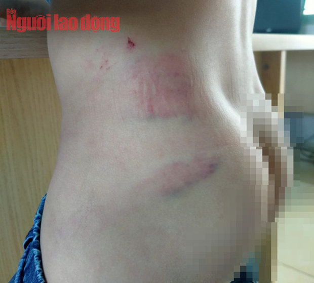CLIP: Bé 9 tuổi kể việc bị cha bạo hành đến toác đầu, mẻ răng CLIP: Bé 9 tuổi kể việc bị cha bạo hành đến toác đầu, mẻ răng